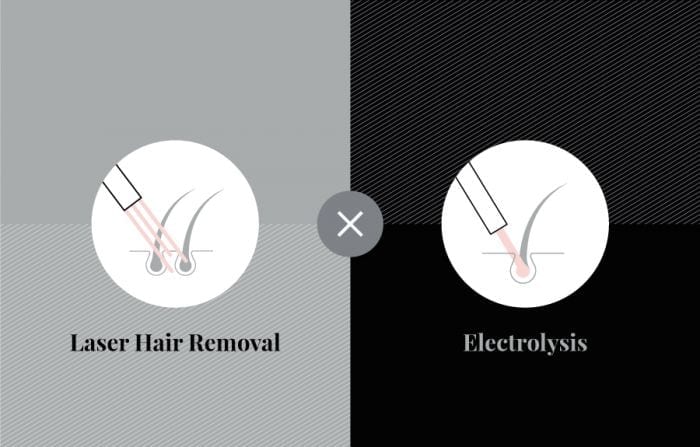 The Difference Between Electrolysis and Laser Hair Removal - | Urbana